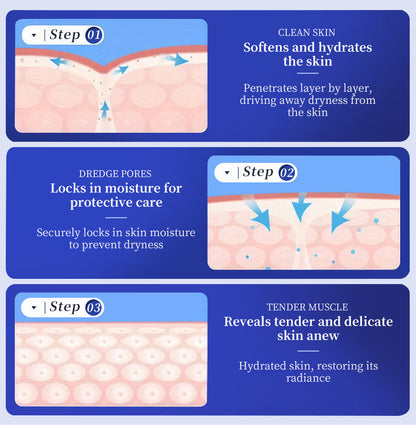 40% Urea Cream - Specifically for Hyperkeratosis, Ichthyosis, Psoriasis, and Eczema