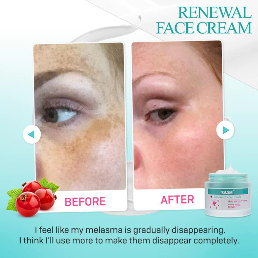 Saam Renewal Face Cream is suitable for moisturizing skin and addressing melasma.